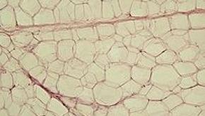 202px-Yellow_adipose_tissue_in_paraffin_section_-_lipids_washed_out.jpg