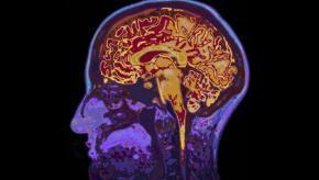 brain.mri2_.jpg