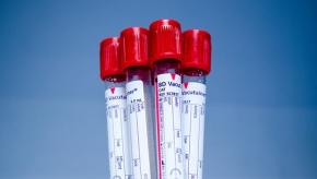 lab.blood-315278__340.jpg
