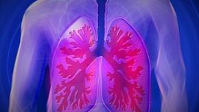 lung%2Cbright.jpg