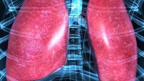 Lungs ILD