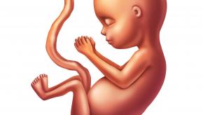 fetus,defect,baby,malformation